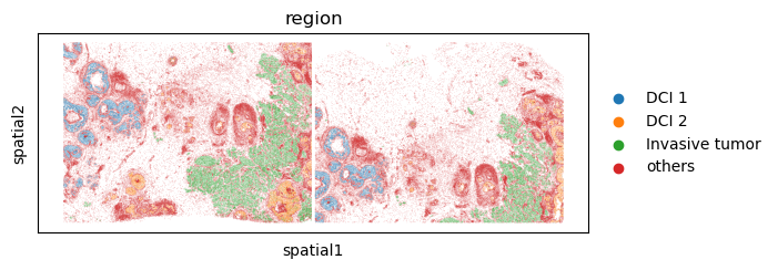 ../../_images/tutorials_human_breast_cancer_xenium_human_breast_cancer_clustering_8_0.png