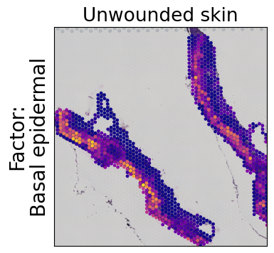 ../../_images/tutorials_mouse_skin_repair_mouse_skin_repair_factors_12_0.png