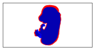 ../../_images/tutorials_3d_reconstruction_3d_stereoseq_rigid_5_5.png