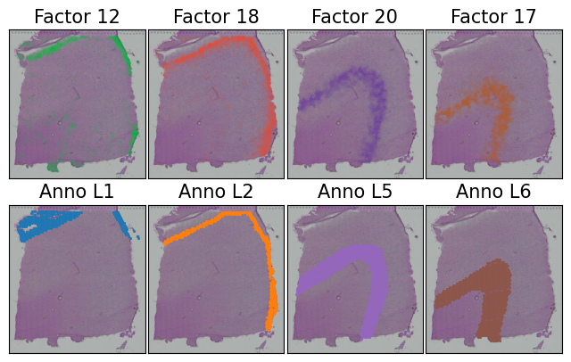 ../../_images/tutorials_DLPFC_DLPFC_spatial_factors_rtd_6_0.png
